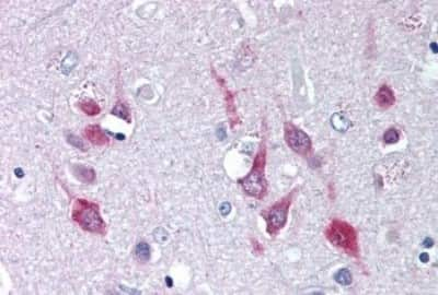 Immunohistochemistry-Paraffin: Cav1.2 Antibody [NBP3-14555]